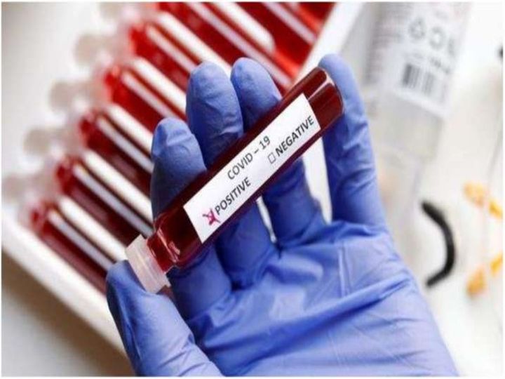 orig covid 19test 1585390930 1585650460 1605213284