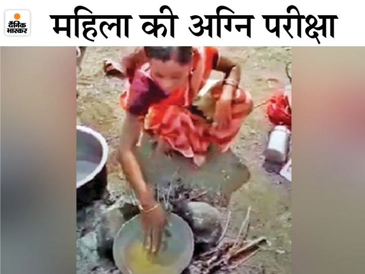 पारधी समुदाय में सच बुलवाने के लिए खौलते तेल में हाथ डलवाने की कुप्रथा है। महिला के पति ने भी इसी मान्यता के आधार पर उसके साथ यह अमानवीय सलूक किया। - Dainik Bhaskar
