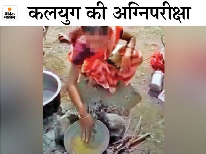 पारधी समुदाय में सच बुलवाने के लिए खौलते तेल में हाथ डलवाने की कुप्रथा है। महिला के पति ने भी इसी मान्यता के आधार पर उसके साथ यह अमानवीय सलूक किया। - Dainik Bhaskar