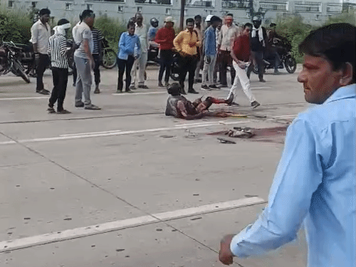 horrific truck accident shakes lucknow biker loses leg vehicle catches ...
