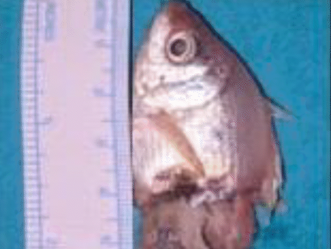 Indore Child Swallows Live Fish; Operation Saves Life | Madhya Pradesh