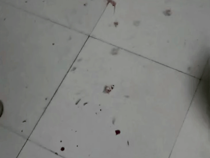Bhopal PG Doctor Fires At Ex-Girlfriend | Shooting Incident & Latest ...