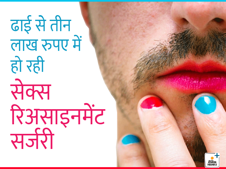 What is gender reassignment surgery महिलाओं के मुकाबले पुरुष ज्यादा