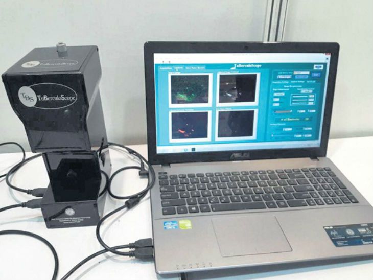 Oral cancer and TB screening machine can be carried anywhere in the bag ...