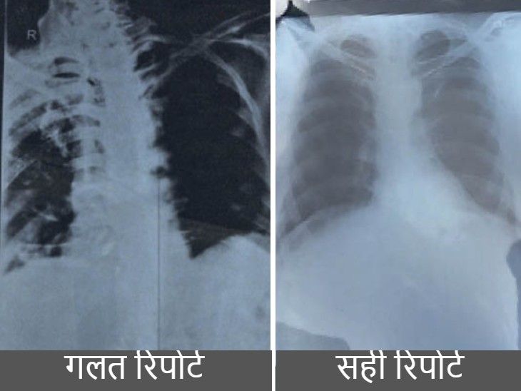 The doctors gave the wrong x-ray in which a lung was visible; So the ...