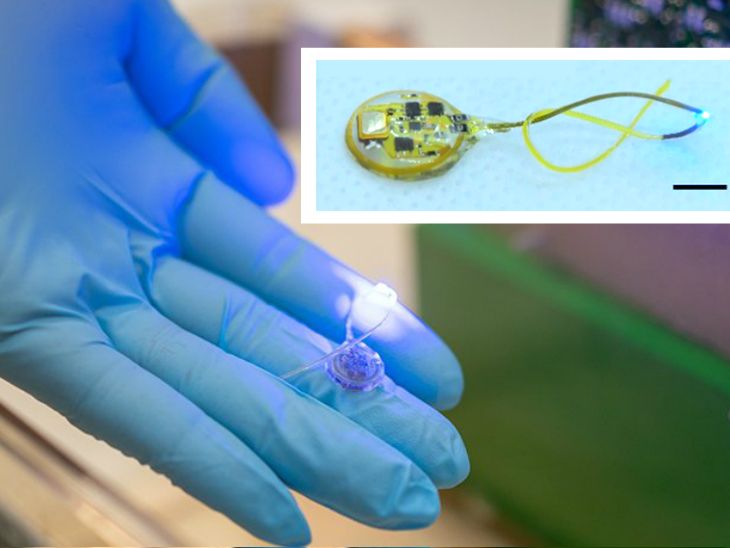 Weight-Loss Device Designed By American Scientists; Here's All You Need ...