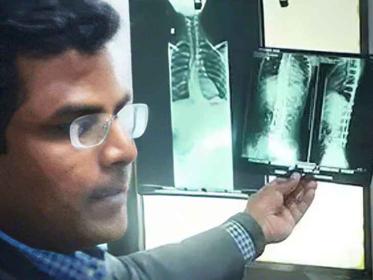 Bangalore Deepak Hospital Spine Surgery Compensation Case | Karnataka News | महिला की रीढ़ में छोड़ी 3 सेमी की सुई: अस्पताल मरीज को 5 लाख का मुआवजा देगा, बेंगलुरु का 20 साल पुराना मामला