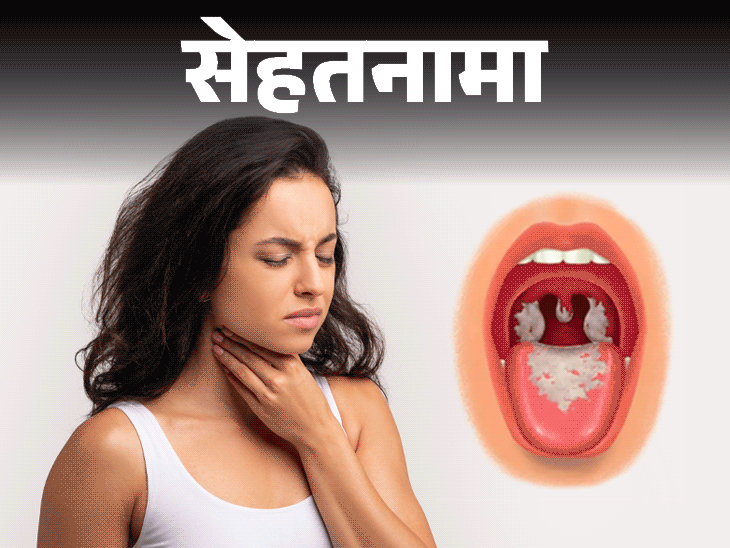 Rajasthan Diphtheria; Bacterial Infection Symptoms Explained