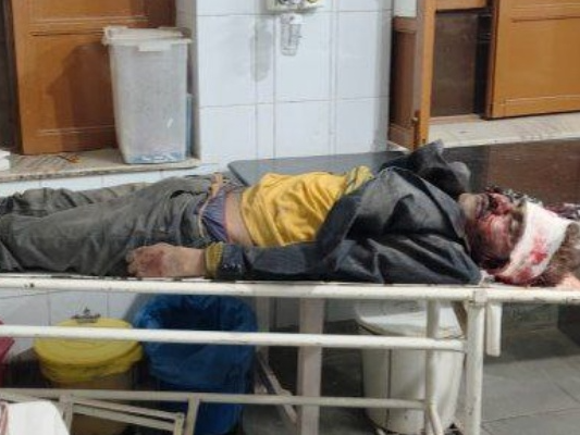 a youngster died in a road accident in pali rajasthan