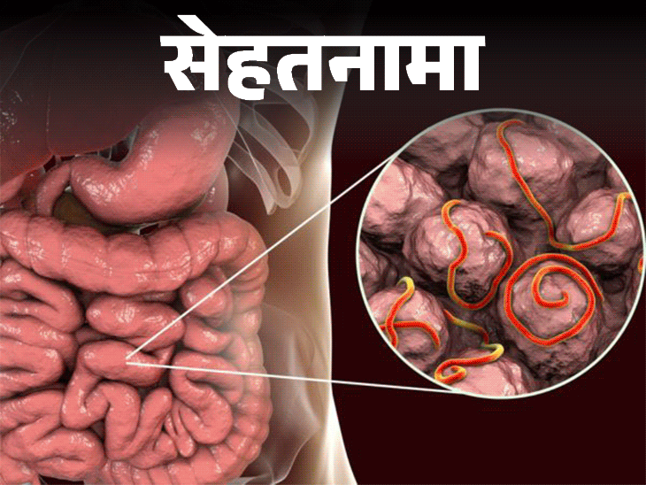 पोटात आतड्यांसंबंधी वर्म्सने स्पष्ट केले (पाळीव प्राणी मी किडे होन के लक्षण) | सेहतानामा- जगातील पोटात जगातील १ million० दशलक्ष लोक: डॉक्टरांकडून शिका, पोटात अळी नसल्यास कसे शोधायचे, कसे मुक्त करावे