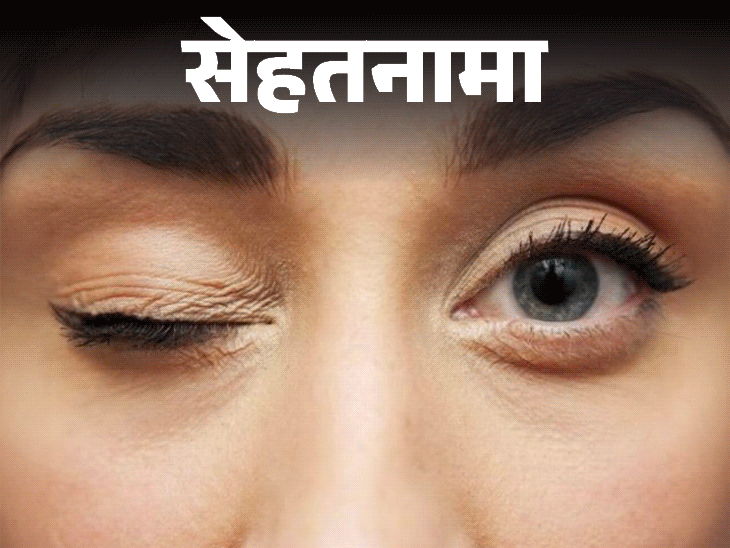 पापणीची कारणे ट्विचिंग; ब्लेफरोस्पाझम लक्षणे आणि कारणे स्पष्ट केली | सेहथानामा- अधिक डोळा फडफडणे हा एक रोग आहे: न्यूरोलॉजिकल स्थिती असू शकते, डॉक्टरांकडून लक्षणे आणि प्रतिबंध जाणून घ्या