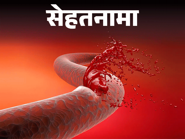 रक्त विकार; हेमोफिलियाची लक्षणे स्पष्ट केली | क्लॉटिंग फॅक्टरची कमतरता | जगातील ११ लाख लोकांसाठी सेहथानमा- हेमोफिलिया: हा आजार काय आहे, ज्यामध्ये रक्तस्त्राव थांबत नाही, डॉक्टरांकडून शिका