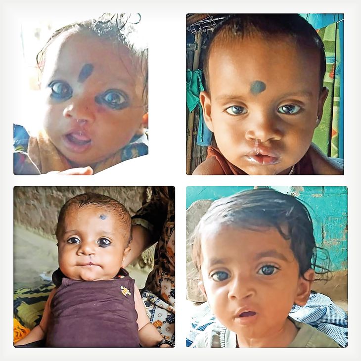 Successful operation of 10 children born with cleft lip and palate; all ...