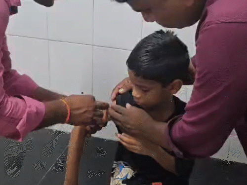 Varanasi, dog and monkey bite cases, anti rabies injection, Deen Dayal ...