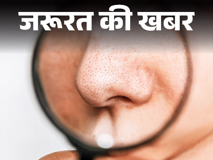 Blackhead Removal: 10 Dermatologist Tips for Clear Skin Blackhead Removal: 10 Dermatologist Tips for Clear Skin