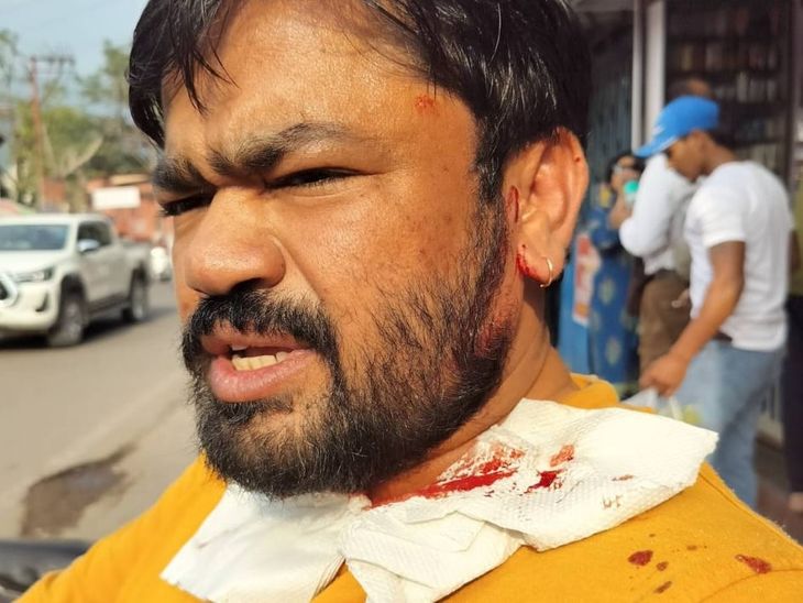 Vishnu Gupta, who filed a petition regarding the dargah, was attacked and received four stitches; two youths on a scooter fled after the incident in Uttarakhand. | दरगाह को लेकर याचिका करने वाले विष्णु गुप्ता पर हमला: चार टांके आए; उत्तराखंड में स्कूटी सवार दो युवक वारदात कर फरार – Ajmer News Vishnu Gupta, who filed a petition regarding the dargah, was attacked and received four stitches; two youths on a scooter fled after the incident in Uttarakhand. | दरगाह को लेकर याचिका करने वाले विष्णु गुप्ता पर हमला: चार टांके आए; उत्तराखंड में स्कूटी सवार दो युवक वारदात कर फरार – Ajmer News