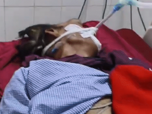 Lucknow - Patient collapses in OT of Balrampur Hospital, got severe ...