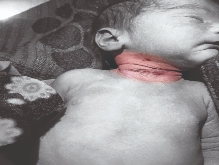 Churu: Incident at the biggest government hospital, mother and aunt | सरकारी अस्पताल की घटना: ऐसी भी क्या दुश्मनी थी; 5 घंटे के नवजात का गला घोंट दिया…मौत – Churu News