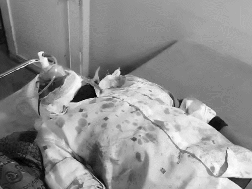 5 सालों ने कुल्हाड़ी से जीजा के पैर काटे, मौत:  तीन दोस्तों के साथ मिलकर किया हमला, बीवी-बच्चों से अलग रह रहा था जीजा – Gujarat News