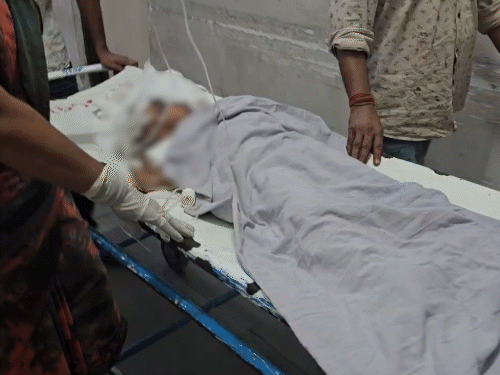 सूरत में 8 साल के बच्चे को कुत्तों ने नोंचा:  सिर से पैर तक आए 50 जख्म, गर्दन पर भी 12-15 सेमी का घाव; हालत गंभीर – Gujarat News