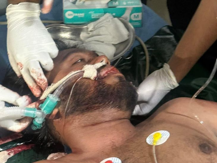 बांग्लादेश में शेख हसीना के विरोधी को गोलियों से भूना:सिर में कई गोली मारी, सोशल मीडिया पर '7 सिस्टर्स' वाला नक्शा पोस्ट किया था