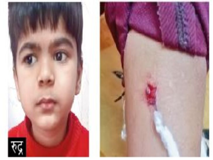 6-year-old boy mauled by 3 dogs, so scared he can't leave the house