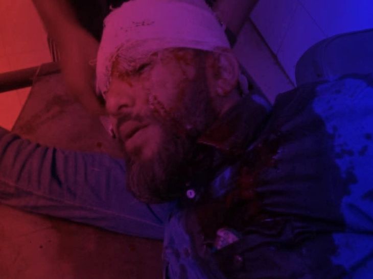 Bangladesh Violence; NCP Student Leader Attack | Motaleb Sikdar | बांग्लादेश में हसीना विरोधी एक और नेता पर हमला: घर में घुसकर गोली मारी, कान के आर-पार निकली, हालत गंभीर