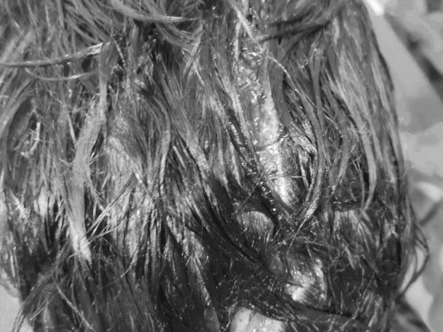 लुधियाना में मासूम पर आवारा कुत्तों ने किया हमला:  पतंग लूटने गए बच्चे को 3 कुत्तों ने नोचा, सिर का मांस तक खा गए – Ludhiana News