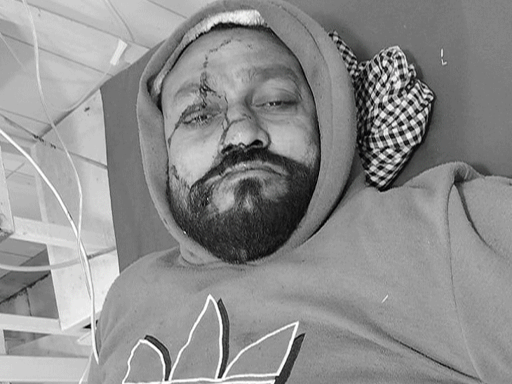 लुधियाना में थार और बाइक की टक्कर:  सब्जी मंडी जा रहे युवक की लात टूटी,अस्पताल में दाखिल करवा भागे दो युवक – Ludhiana News