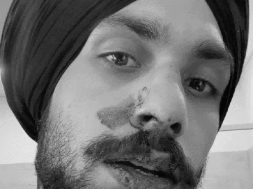 ऑस्ट्रेलिया में सिख युवक को इंडियन डॉग कहा:  ऑस्ट्रेलियाई युवकों ने जिम के बाहर घेरा, ‘वापस जाओ’ के नारे लगाए; नाक की हड्‌डी तोड़ी – Ludhiana News