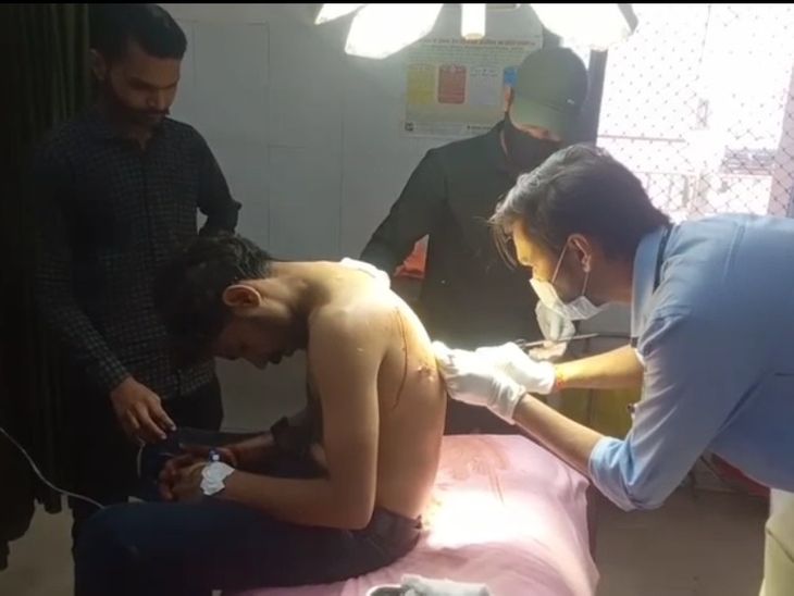 युवक को गाड़ी से उतारकर चाकू मारे,पीठ पर 8 घाव:  सतना में पहले दो बार मारपीट-अभद्रता हो चुकी; आरोपी और घायल एक मोहतल्ले के – Satna News