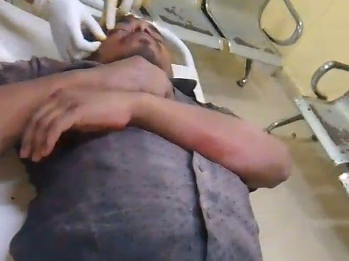 अज्ञात वाहन की टक्कर से बाइक सवार गंभीर घायल:भगवानपुर ओवरब्रिज पर जख्मी हाल में मिला, डायल 112 पुलिस ने अस्पताल पहुंचाया