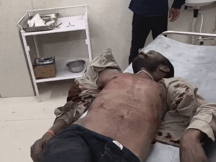 पैरोल पर छूटे हिस्ट्रीशीटर ने गोली मारी, व्यक्ति की मौत:  दो पीठ, 1-1 गर्दन, पेट और पसली में लगीं गोलियां; बेटे पर भी फायरिंग – Satna News