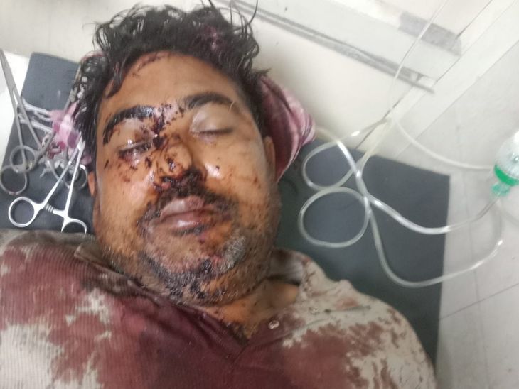 पानीपत में दुकान के एडवांस किराया पर खूनी संघर्ष:  दुकानदार पर चाकूओं से किया हमला, सिर और गर्दन पर आई गंभीर चोटें – Panipat News