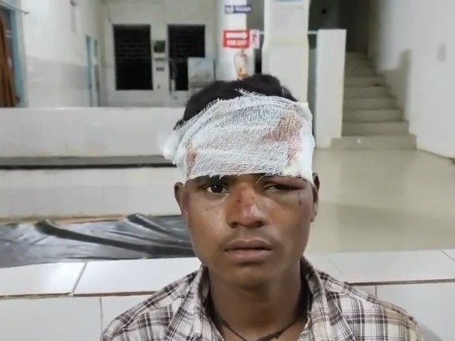 बाइक फिसलने से चाचा की मौत, भतीजा घायल:  रास्ता भटकने के बाद बाइक फिसलने से हादसा; दोनों रिश्तेदारी में जा रहे थे – Damoh News