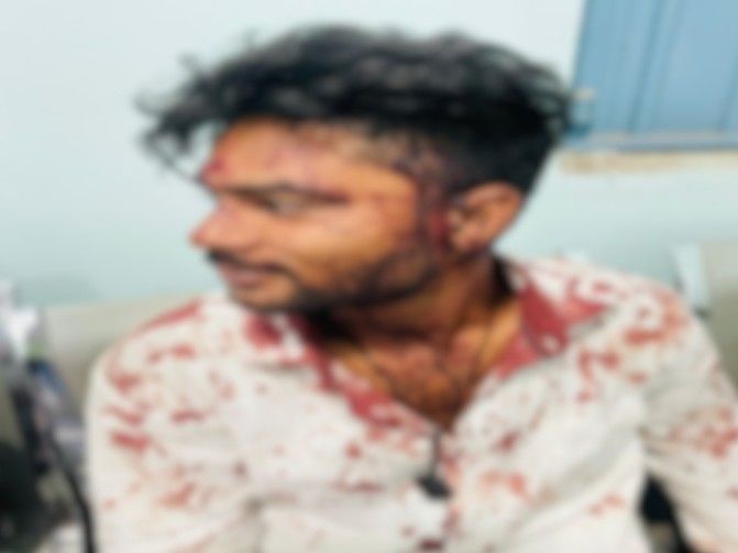 रायपुर में युवक पर तलवार-कड़े-चाकू से हमला…VIDEO:  सिर, माथे और हाथ में आई चोट, पुलिस पर युवक पर लगाया मामूली कार्रवाई करने का आरोप – Raipur News