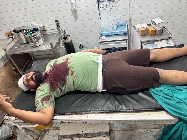 बरनाला में अवैध शराब बेचने से रोकने पर जानलेवा हमला:  धारदार हथियार लगने से ठेका कर्मचारी घायल, 7-8 लोगों के खिलाफ केस – Barnala News