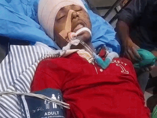 तरनतारन में युवक पर हमला, सिर में लगी गोली:  काम से कहीं जा रहा था, रास्ते में अज्ञात बदमाशों ने की फायरिंग, हालत नाजुक – tarn-taran News