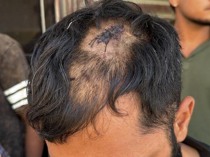 मोहाली में मारपीट मामले में 4 आरोपी गिरफ्तार:  नशा तस्करी के आरोपों की भी होगी जांच, डोप टेस्ट कराने की तैयारी – Mohali News