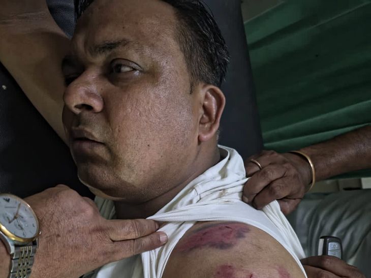 मोगा में कोठी विवाद को लेकर पिता-पुत्र में विवाद:  बचाव में गए भाई को पीटा, कैश-मोबाइल छीनने का आरोप, 14 लोगों पर FIR – Moga News