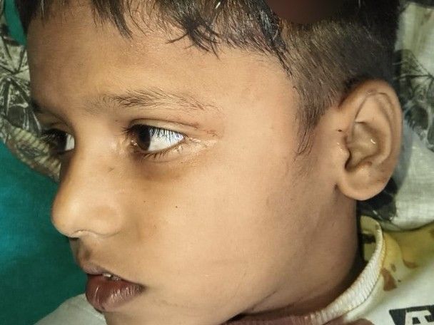 पटियाला में घर में घुसकर परिवार पर हमला:  बच्चे समेत तीन लोग घायल, पुरानी रंजिश में दिया वारदात को अंजाम – Patiala News