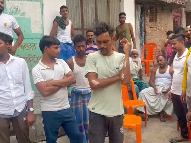 बक्सर में युवक से बर्बरता; नाखून उखाड़े; गर्म खुरपी से दागा
