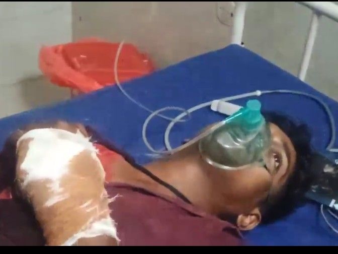 अररिया में मुखिया पर जानलेवा हमला; भूमि विवाद सुलझाते वक्त हाथ पर वार