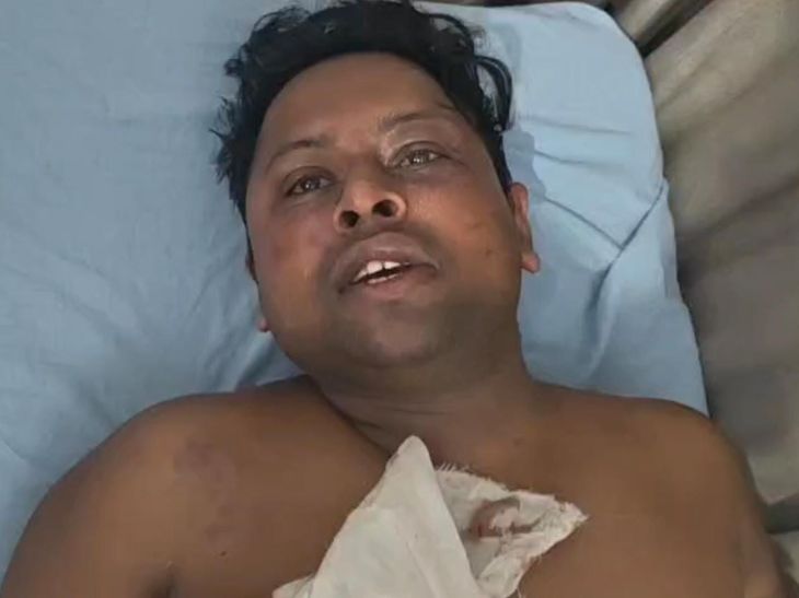 हमीरपुर पुलिस की लापरवाही; वारंटी की जगह दूसरे युवक को उठाया, बेरहमी से पिटाई