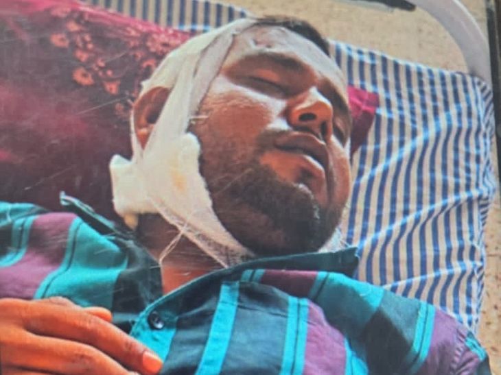 मेरठ जेल में बंदी पर नुकीली वस्तु से हमला; गर्दन की नस कटी