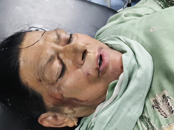 मोबाइल छीनकर भाग रहे लुटेरे लोगों के हत्थे चढ़े:  कपूरथला में महिला से मोबाइल झपटा था, वारदात में स्कूटी से गिरकर दो लोग घायल – Kapurthala News