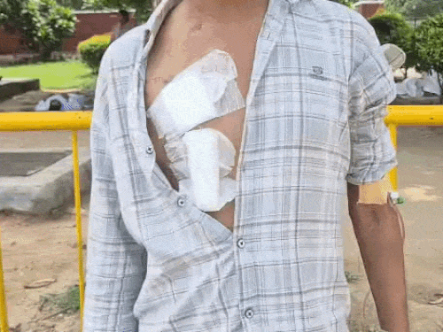 
                 चंडीगढ़- मां ने बेटे को बचाने के लिए किडनी दी:मोहाली में ₹7 लाख का ट्रांसप्लांट फेल, अब मां-बेटे दोनों बीमार; 1 बीघा जमीन भी बिकी 
            