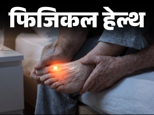 दुनिया भर में तेजी से बढ़ रहे गाउट के मामले, पुरुषों में तीन गुना ज्यादा खतरा