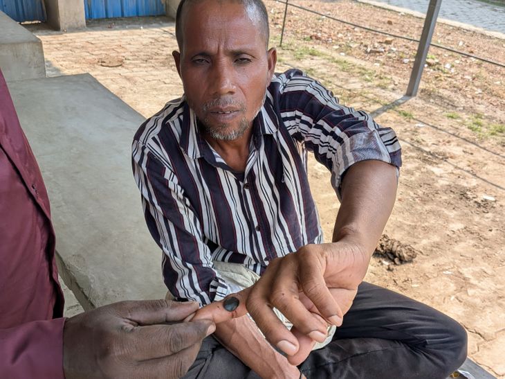 Snake Bite Incident in Shankergarh | Prayagraj Farmer Out of Danger