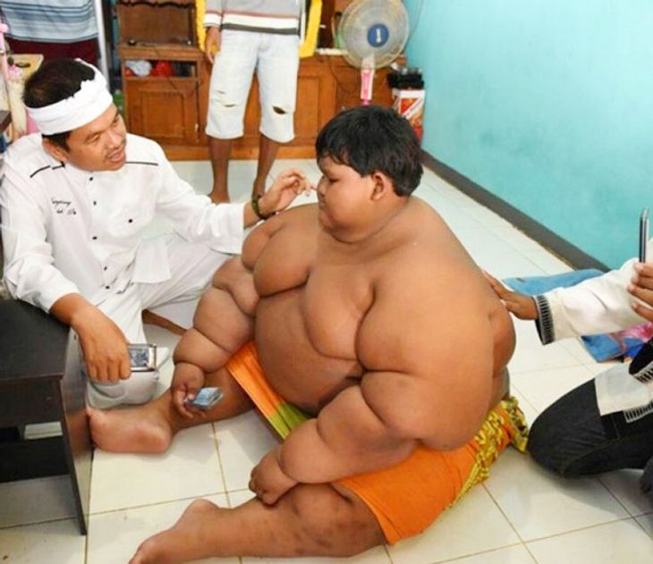 Worlds Fattest Boy Arya Permana Loses Almost Half His Weight | जगातील ...